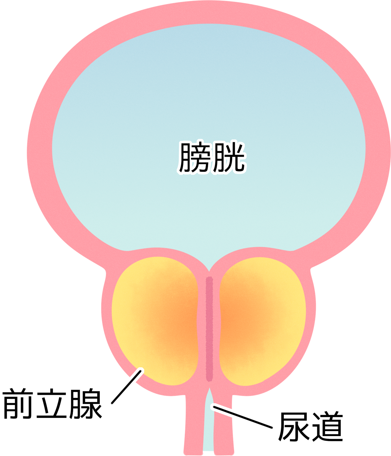 前立腺肥大